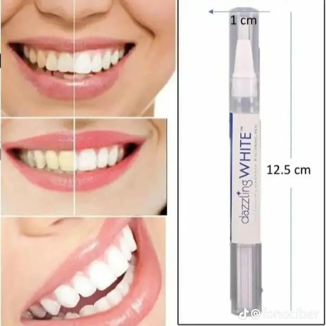 🦷 Lápiz Blanqueador Dental Lleva 2x1